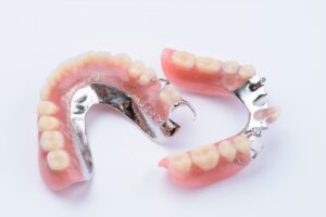 implant dentures tamworth