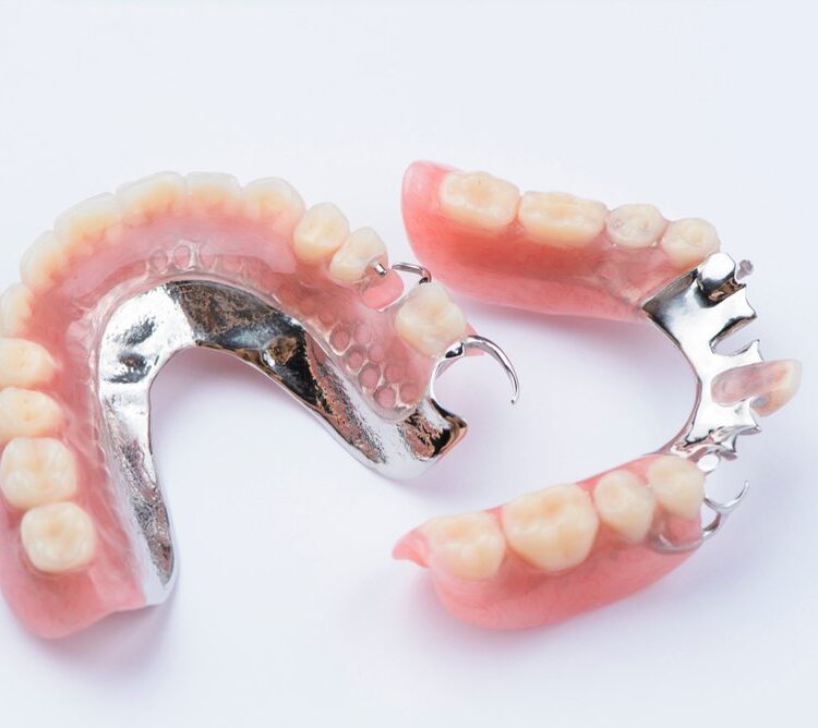 implant dentures tamworth