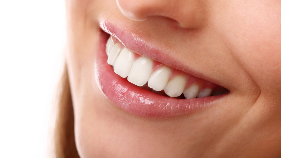 Dental Implant Centrepoint Dental Tamworth