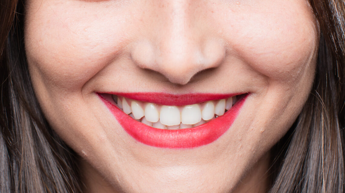 Centrepoint Dental teeth whitening Tamworth