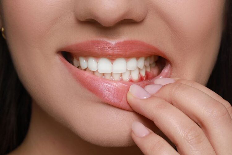 Bleeding Gums & Gum Disease What Are the Signs